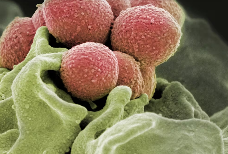 Lee más sobre el artículo Streptococcus pyogenes: cuáles son los síntomas de la infección y cómo es el tratamiento