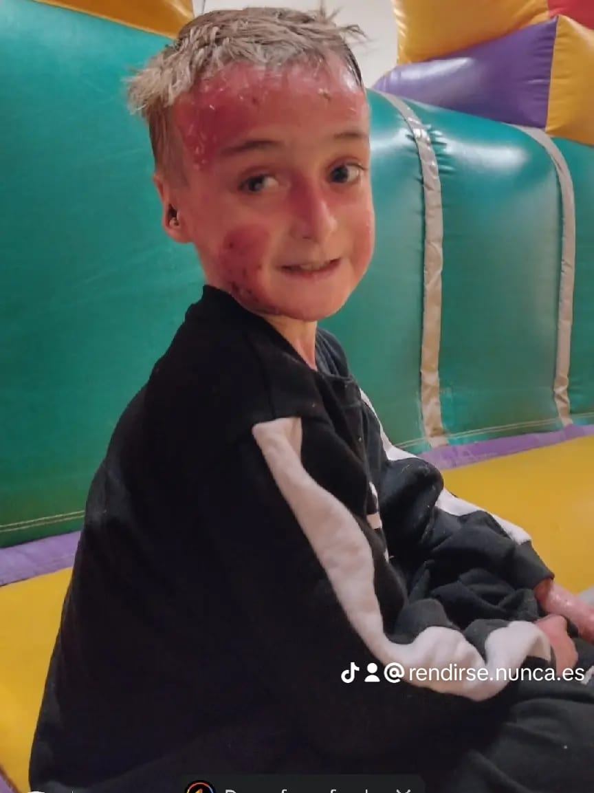 Lee más sobre el artículo Una rifa solidaria por Noah: necesita viajar a Buenos Aires para controles médicos