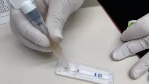 Lee más sobre el artículo Salud ofrece un test de detección de cáncer colorrectal de forma gratuita