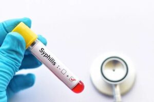 Lee más sobre el artículo Sífilis en aumento: Argentina alcanzó los 46.000 casos en 2025