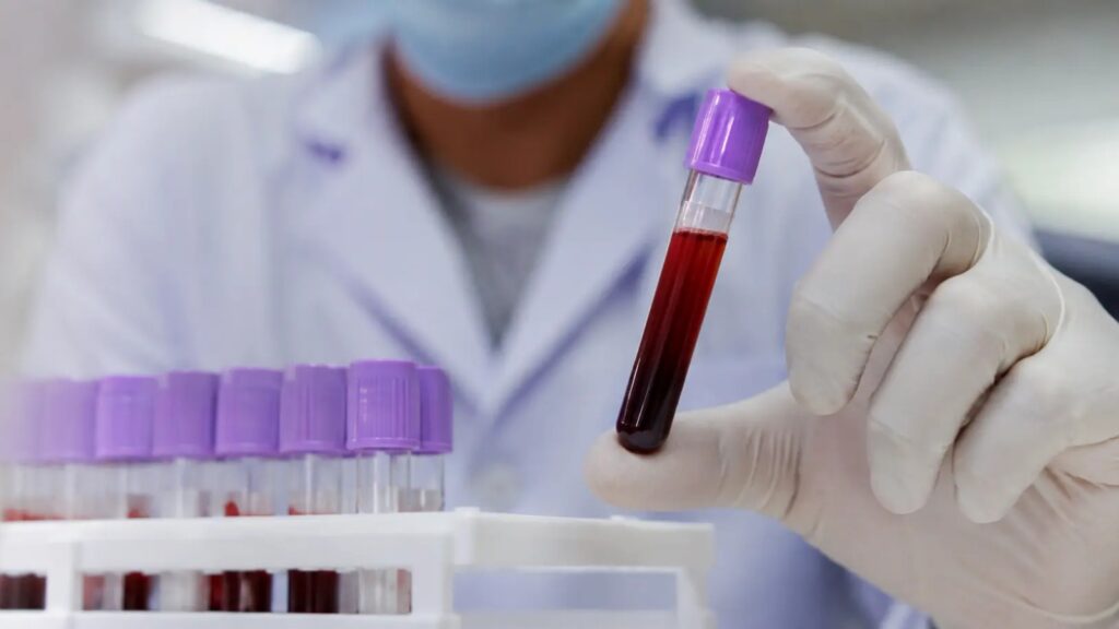 IPROSS acompañó a 15 afiliados en tratamientos de trasplante de médula ósea