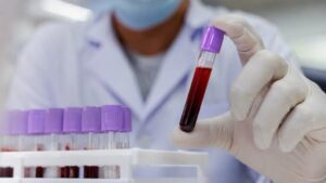 Lee más sobre el artículo IPROSS acompañó a 15 afiliados en tratamientos de trasplante de médula ósea