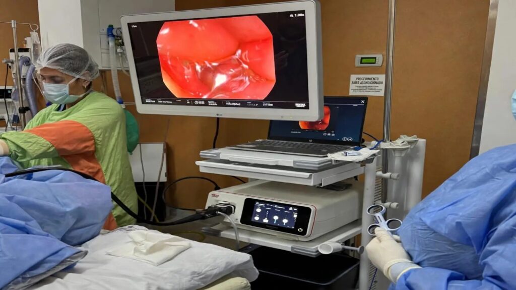 Río Negro suma equipamiento para mejorar la detección temprana del cáncer colorrectal